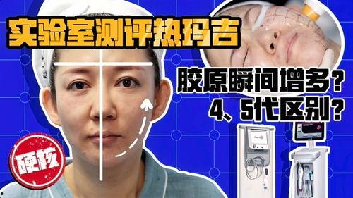 新氧明星整形,揭秘明星美丽背后的秘密